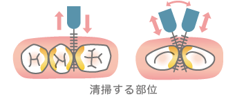 ԃuVŐ|镔